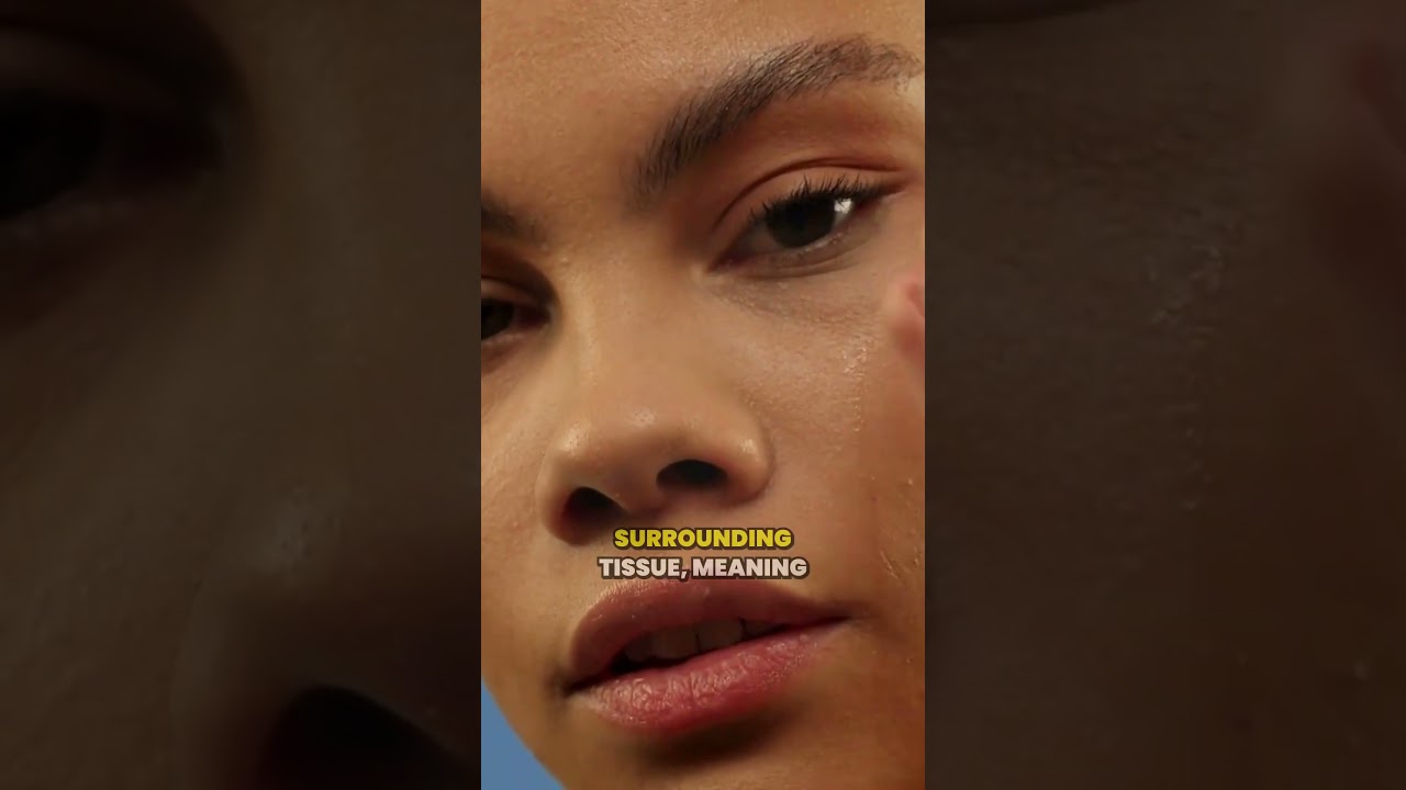 The Benefits of Pixel Perfect CO2 for Sensitive Skin