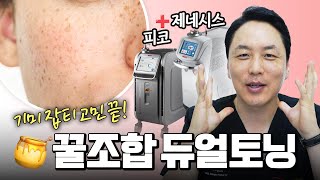 색소, 기미, 잡티 완벽 제거는 토닝+토닝? 최고의 조합은? (feat.레이저, 피코, 제네시스)