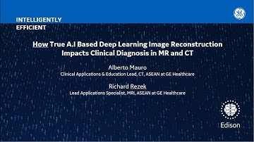 How True A.I based Deep Learning Image Reconstruction Impacts Clinical Diagnosis in MR & CT