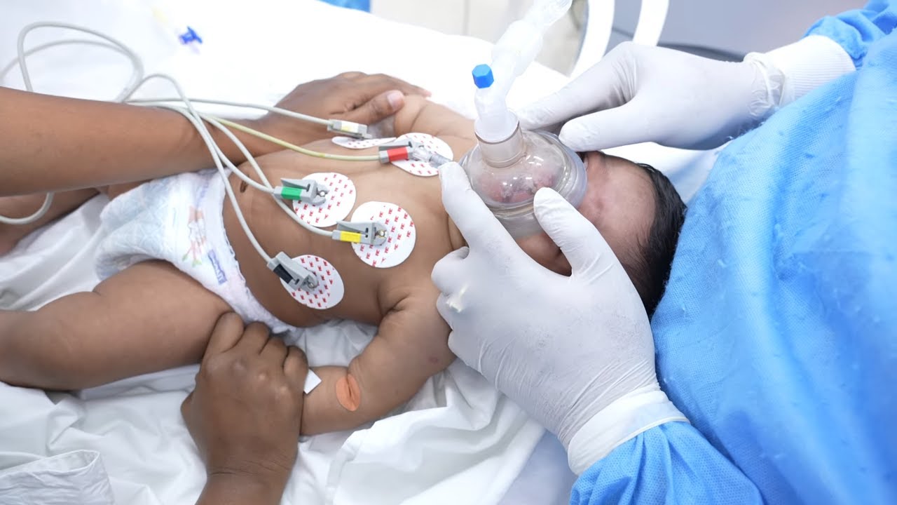 Cute 1 month old baby going under deep sleep anesthesia YouTube