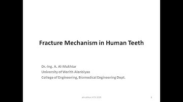Fracture Mechanism in Human Teeth - Almukhtar