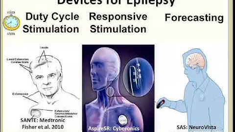 Current & Next Generation Devices for Epilepsy