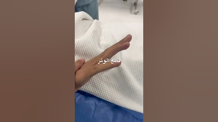 حالة قطع الإصبع المطرقة