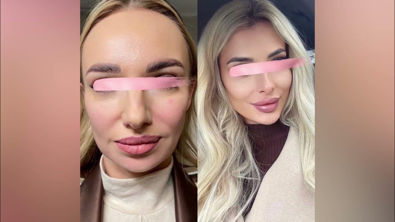 Методика Full Face (Фулл Фейс). Омоложение и гармонизация лица ...