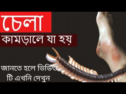 ভিডিও: কাঁটা ঝোপ কি বিষাক্ত?