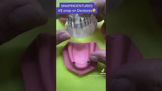 Snap in Dentures vs Snapon Dentures