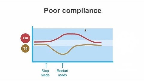 How to identify subclinical hypothyroidism.