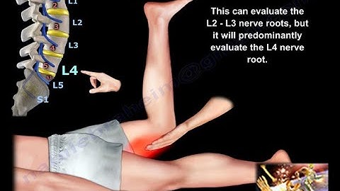 Femoral Tension Sign - Everything You Need To Know - Dr. Nabil Ebraheim