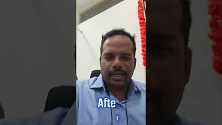 🍽️ CGM Continuous Glucose Monitoring, - Blood Sugar Before and After Food -  Breakfast - Dosa🤔💡