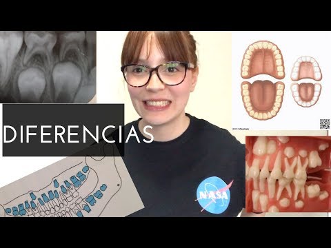 Video: Cómo Identificar La Dentición