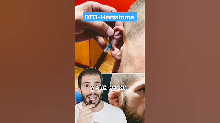 ¿Hematoma en la oreja? (OTOHEMATOMA) Evita la OREJA en COLIFLOR en luchadores