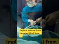 Implant removal #bone #implant #fracture #patient #doctor #neet #shortsfeed #viral