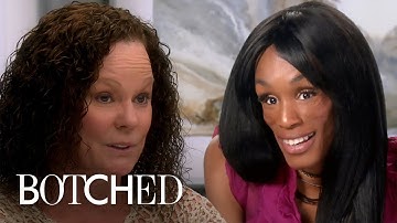 5 Botched MIRACLES From Season 5 | E!