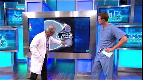 Baseball Eye Injury Explained - Assil Eye Los Angeles on The Doctors