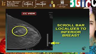 Tomosynthesis an approach to interpretation Prof  Michael Linver