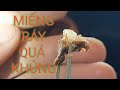 Lấy Ráy Tai Mảng Ráy To Khủng Khiếp