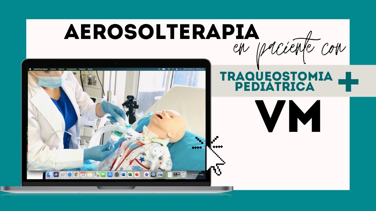 Aerosolterapia en Traqueostomia conectada a la Ventilación Mecánica