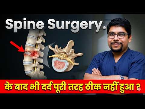 Failed Back Surgery Syndrome क्या होता है ? spine surgery के बाद दर्द पूरी तरह ठीक नहीं |  जाने कारण