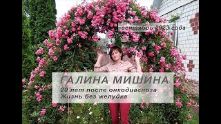 Галина Мишина, 20 лет после онкодиагноза. Жизнь без желудка