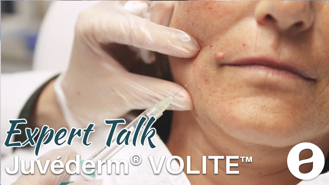 Juvéderm® VOLITE™ Facial Rejuvenation Intradermal Filler - Expert Talk