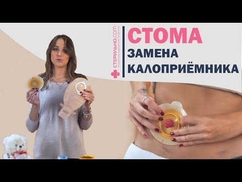 Как заменить двухкомпонентный калоприемник для стомы?   | Стерильно.com