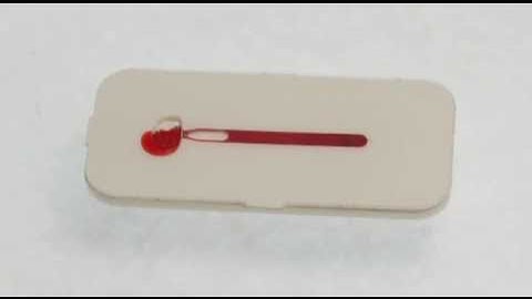 DBS chip sampling procedure