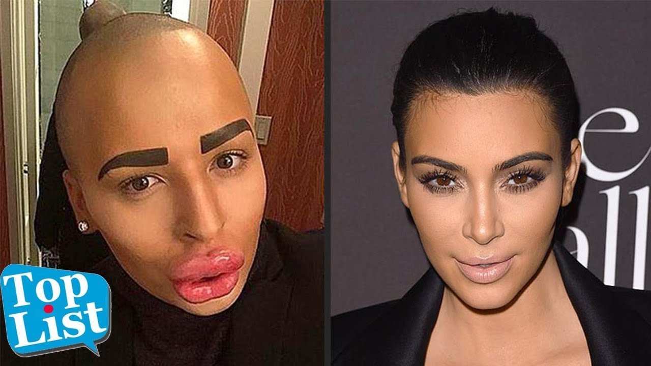 20 People Who Had Surgery To Look Like Someone Else Strange Plastic Surgery Youtube