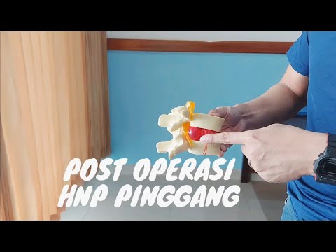 Operasi HNP LUMBAL. 