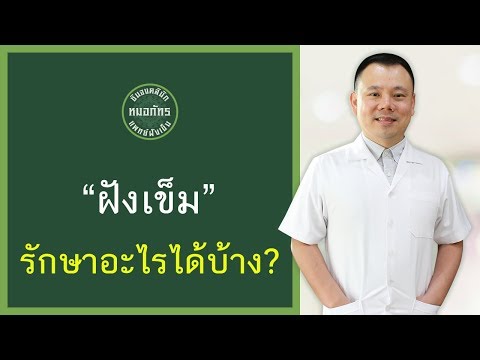 "ฝังเข็ม" รักษาโรคอะไรได้บ้าง?