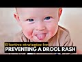 From Irritation to Radiant Skin: Managing Drool Rash with Care