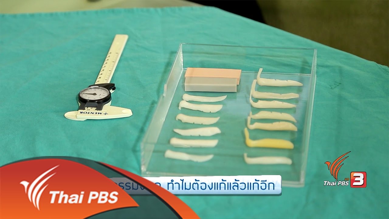 รู้สู้โรค : ศัลยกรรมจมูก ทำไมต้องแก้แล้วแก้อีก (27 ก.พ. 60)