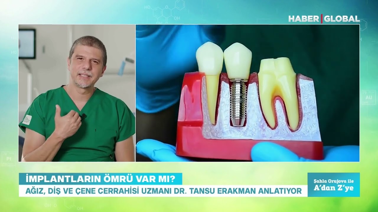 Çabuk Anlatımla İmplant Ömrü Ne Kadardır?