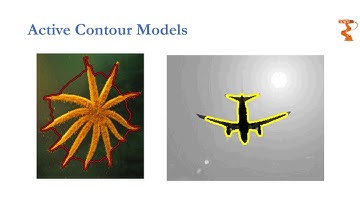 Active Contour Segmentation