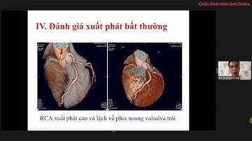 ỨNG DỤNG CHẨN ĐOÁN HÌNH ẢNH TRONG BỆNH LÝ TIM MẠCH | ThS. BS. Dương Phi Sơn