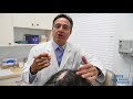Surgical Options for Lichen Planopilaris, Scarring Alopecia & Lupus