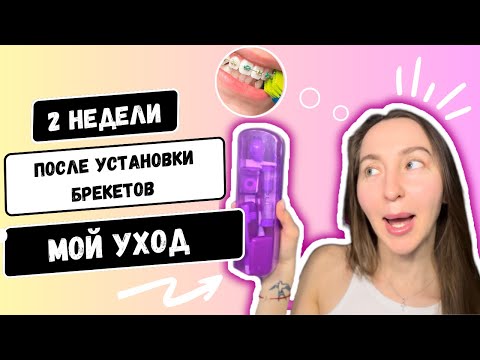 МОЙ УХОД ЗА БРЕКЕТАМИ 🧺🧼: какими средствами пользуюсь/две недели после установки брекетов