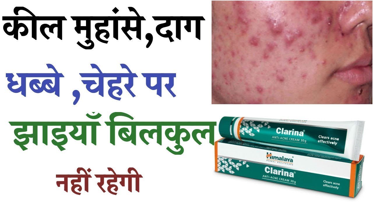 himalaya clarina cream ke fayde in hindi