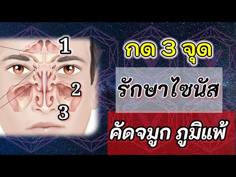 วีดีโอ: 3 วิธีนอนหลับสบายกับปัญหาไซนัส