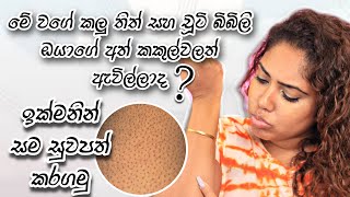 How to cure strawberry skin | Sinhala beauty tips 2023