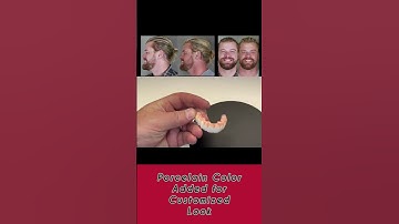 Zirconia Bridge Process