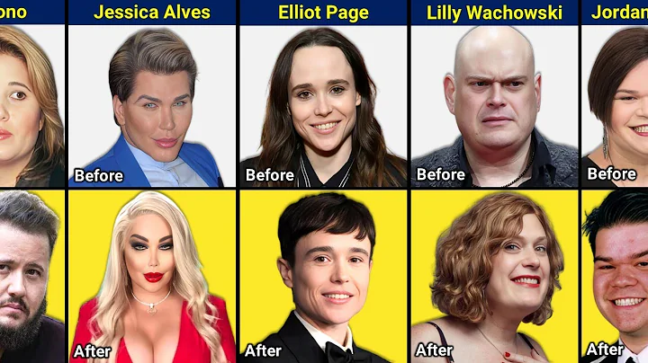 35 Celebrities Who Underwent Gender Transition - Before and After