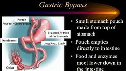 Introduction to Bariatric Surgery