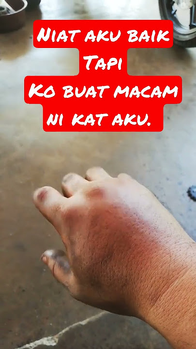 Berdenyut Tangan Aku #viral #youtubeshorts #shortsvideo #funny #shortvideo