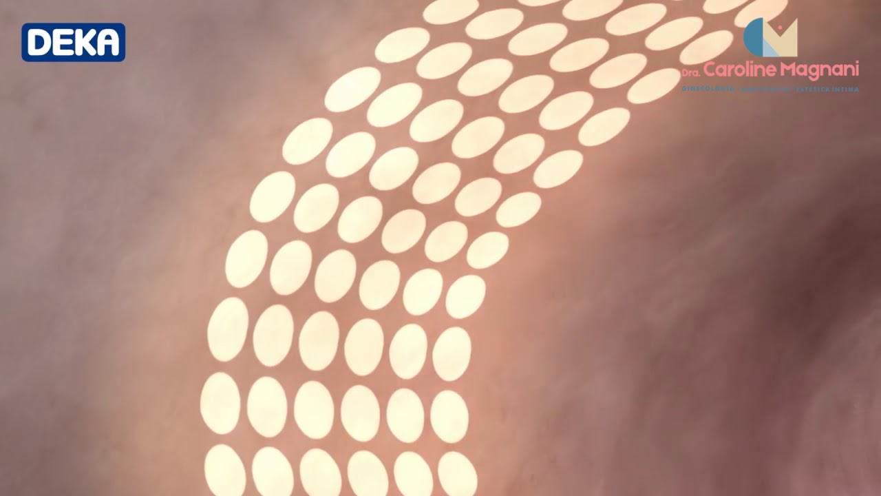 Estética Íntima Feminina e Rejuvenescimento Vaginal - Dra. Caroline Magnani