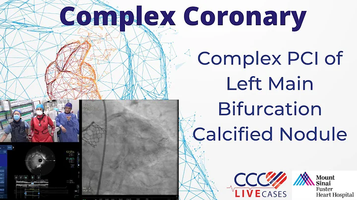 Watch Live Complex PCI of Left Main Bifurcation Calcified Nodule