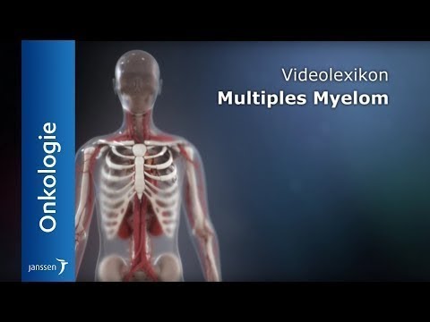 Video: Myelom - Symptome, Behandlung, Prognose