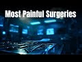Most Painful Surgeries Explained | Top 10 Surgeries That Hurt the Most