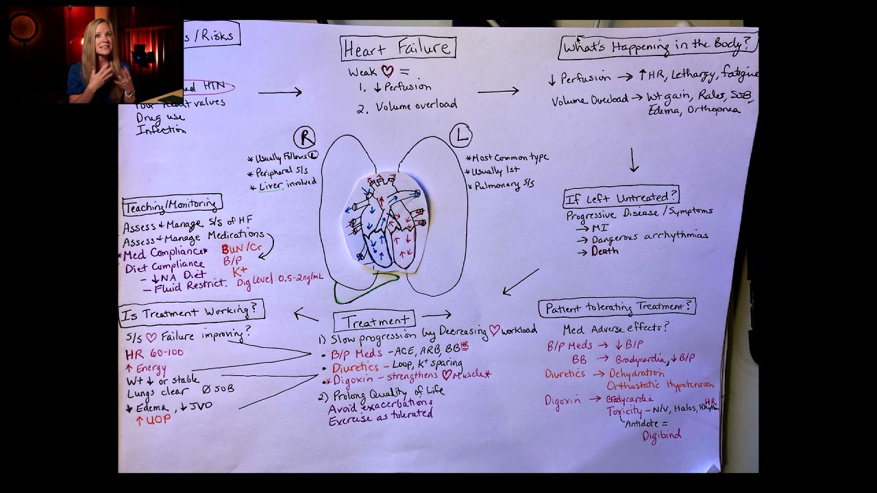 nursing concept maps for chf