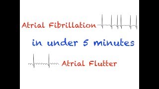 AFib and AFlutter Interpretation Under 5 minutes