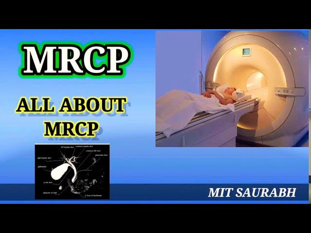 mrcp-procedure-ppt-uk-store-gbu-taganskij-ru